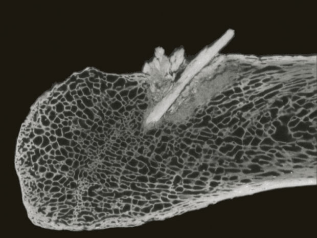 Radiografia da costela mostra detalhes do osso fincado. (Foto: Texas A&amp;M University)