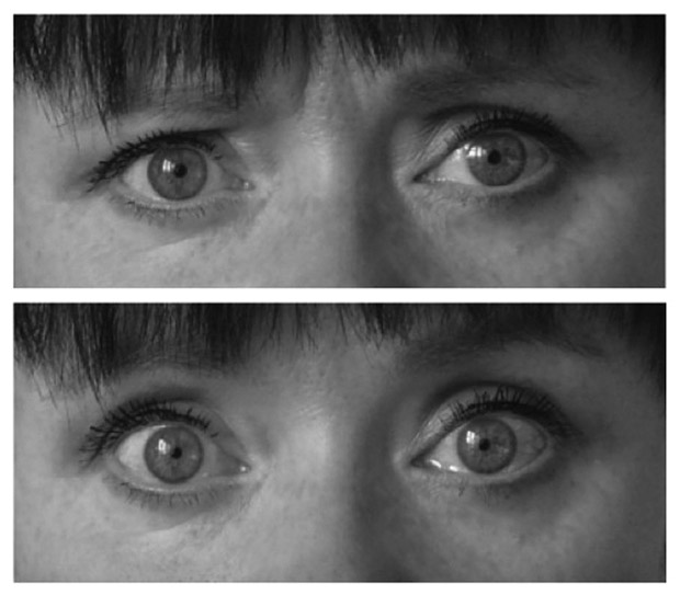 Na primeira imagem, olhos de uma pessoa consciente; na segunda, em estado de hipnose (Foto: Universidade de Turku/Divulgação)