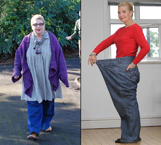 Emma Boronat antes e depois da dieta (Foto: Worldwide Features/Barcroft Me/Getty Images)