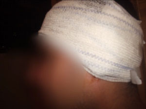 Vítima foi agredida com quatro coronhadas na cabeça (Foto: Reprodução/ Tv Integração)