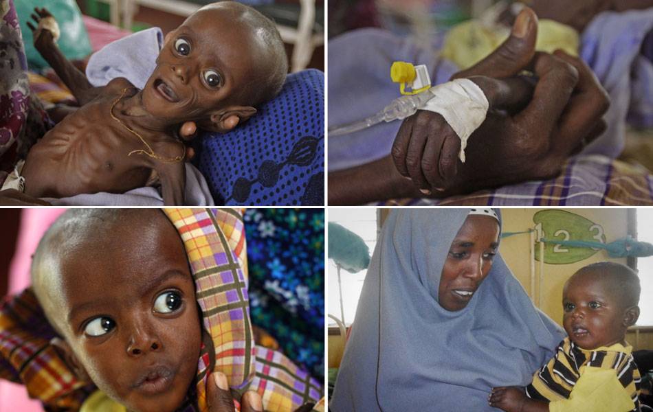 Imagens mostram o crescimento de Minhaj Gedi Farah, bebê somaliano que chegou ao acampamento de refugiados da fome de Dadaab sofrendo de desnutrição aguda em julho deste ano. Após 4 meses recebendo tratamento e comida, a criança superou a enfermidade.