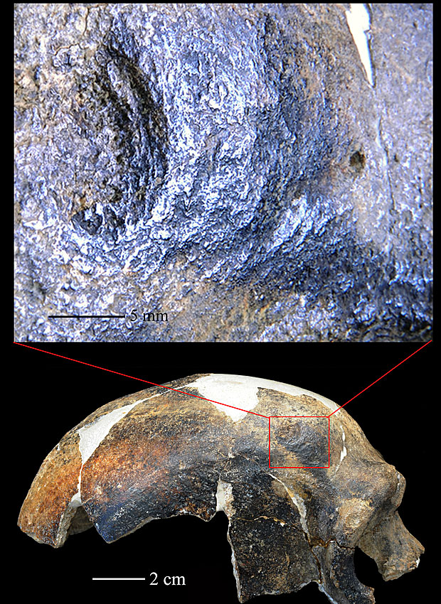 Detalhe do pedaço amassado do crânio de 126 mil anos (Foto: University of the Witwatersrand)
