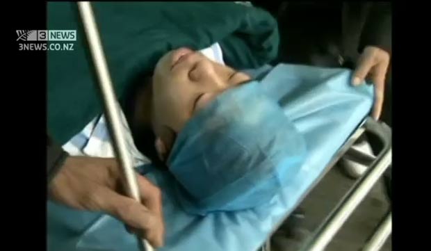 Médicos retiraram uma sanguessuga da traqueia de adolescente chinês. (Foto: Reprodução/3 News)