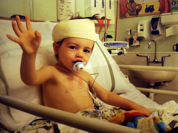 O pequeno Thomas Miller fez várias cirurgias para drenar abscessos no cérebro (Foto: Caters News)