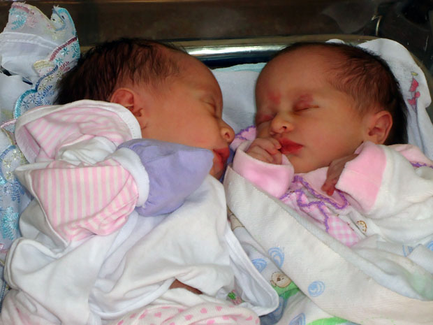 Viviane e Vivian nasceram pré-maturas, mas passam bem (Foto: Antônio Vieira/TV Cabo Branco)