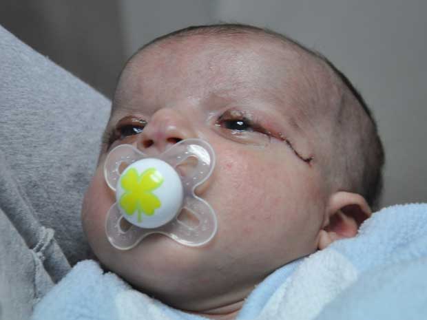 Nome do bebê submetido à cirurgia não foi divulgado (Foto: BBC)