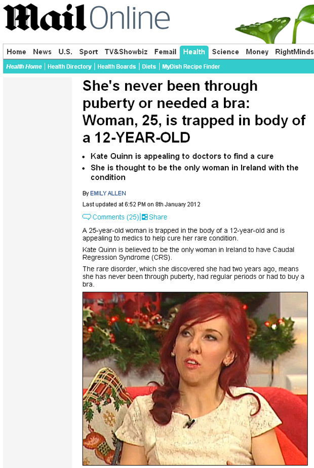 Irlandesa Kate Quinn nunca entrou na puberdade. (Foto: Daily Mail / Reprodução)