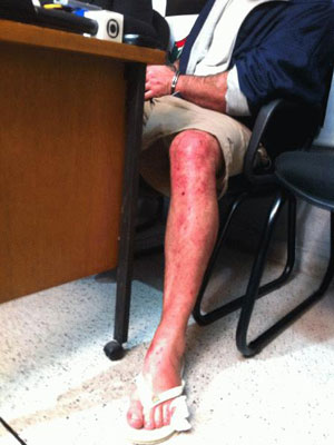 Costa apareceu na delegacia com ferimentos na perna (Foto: Paulo Toledo Piza/G1)