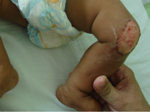 Lesão no joelho do bebê de 6 meses (Foto: Divulgação/Polícia Civil)