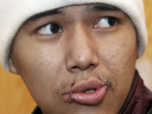 Preso com os lábios costurados em prisão de Bishkek, no Quirguistão, nesta terça-feira (24) (Foto: AP)