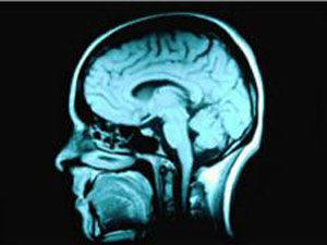 Ondas cerebrais revelam palavras em que pensamos (Foto: BBC)