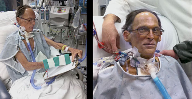 Craig Lewis é o primeiro homem do mundo a viver sem o coração (Foto: Divulgação/Herzliya Films)