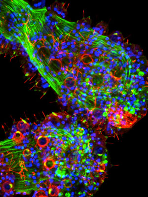 Essa imagem da hidra mostra a opsina e azul e as células sensoriais e os cnidócitos em vermelho (Foto: Dr. David Plachetzki, University of California)