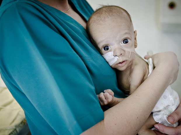 Bebê de origem romena nasceu sem intestinos e espera por operação (Foto: Vadim Ghirda/AP)