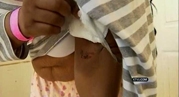 Vítima mostra seus ferimentos à TV local (Foto: Reprodução de vídeo)