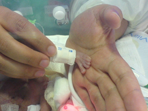 Carolina Terzis nasceu com 27 centímetros, na 25ª semana de gestação. (Foto: Arquivo Pessoal)