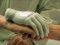 Mão biônica que será implantada (Foto: BBC)