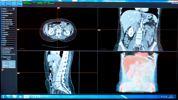 Software reconhe órgãos do corpo humano em exames e auxilia nos diagnósticos. (Foto: Divulgação)