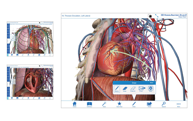 Visible Body Human Anatomy Atlas Cracked 22