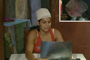 Três meses depois, mulher tem bala retirada da cabeça no DF
(Reprodução/TV Globo)
