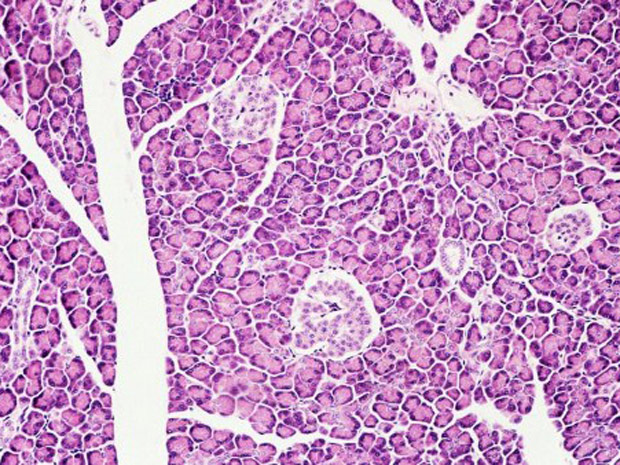 Falha em células das ilhotas de Langerhans são uma das causas para o desenvolvimento de diabetes do tipo 2. (Foto: Image Source / AFP Photo)