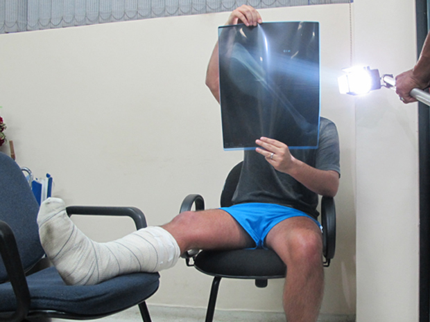 Vítima mostra exame de fratura na perna  (Foto: Roney Domingos/ G1 )