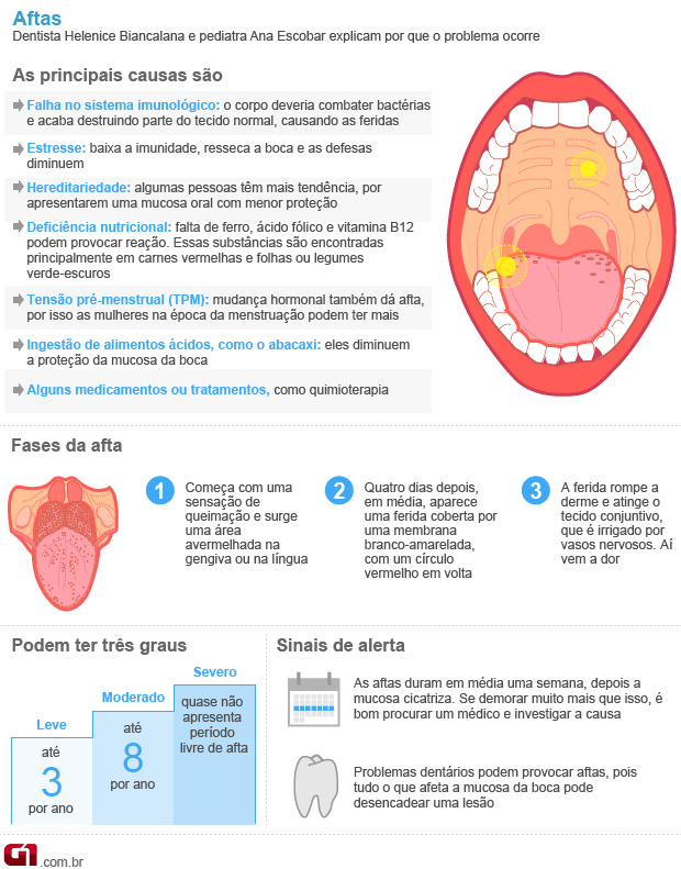 Afta na garganta: 7 principais causas (e o que fazer) - Tua Saúde