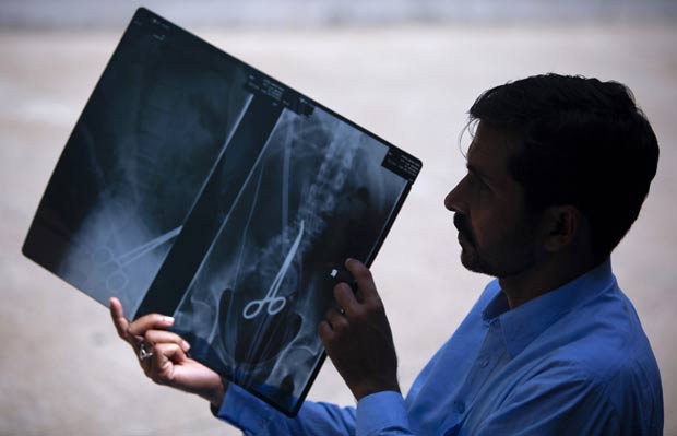 Safdar Ali Shah, de 36 anos, exibe raio-X que mostra a pinça em seu corpo. (Foto: Akhtar Soomro/Reuters)