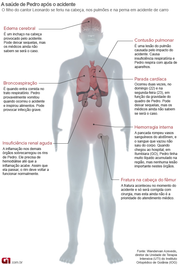 Info quadro clínico cantor Pedro (Foto: arte/G1)